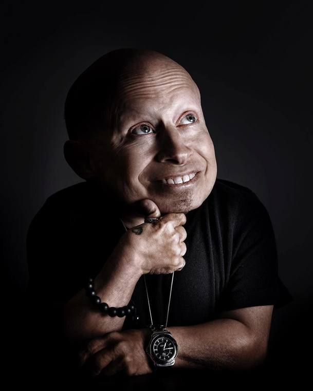 Zemřel Verne Troyer, malý herec s velkým smyslem pro humor | Fandíme filmu