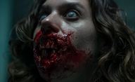 Yummy: Nová zombie komedie z Evropy je už v traileru patřičně utržená ze řetězu | Fandíme filmu