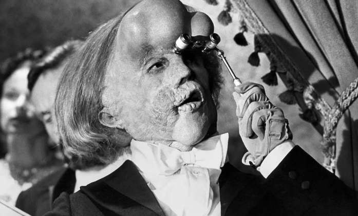 Joseph Merrick: Muž proslulý svou genetickou poruchou dostane nový film | Fandíme filmu